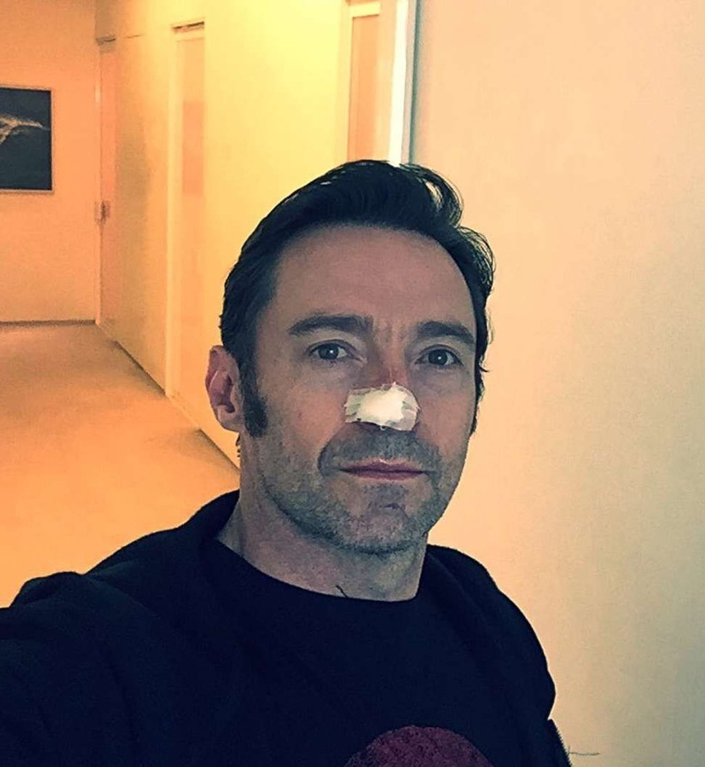 The photo Hugh Jackman posted on Instagram.