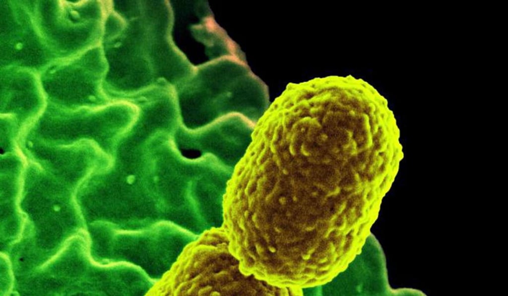 Two mustard-colored, rod-shaped carbapenem-resistant Klebsiella pneumonias bacteria are part of the family of germs known as Enterobacteriaceae. Photo: Handout by National Institute of Allergy and Infectious Diseases Two mustard-colored, rod-shaped carbapenem-resistant Klebsiella pneumonias bacteria are part of the family of germs known as Enterobacteriaceae. Photo: Handout by National Institute of Allergy and Infectious Diseases