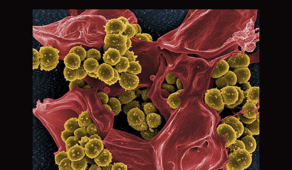 In the United States, antibiotic-resistant infections kill an estimated 23,000 Americans each year. Photo: Handout