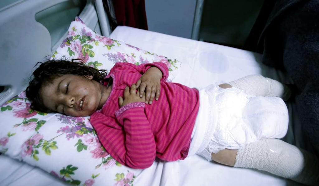 Dima Nadm Hamid, 3 years old, is treated for possible exposure to chemical weapons agents in a hospital west of Erbilin Mosul. Photo: Reuters