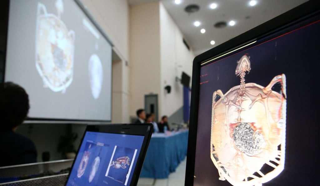 Screens show a CT scan of Omsin during a news conference at Chulalongkorn University in Bangkok on Monday, her belly packed with coins. Photo: Reuters