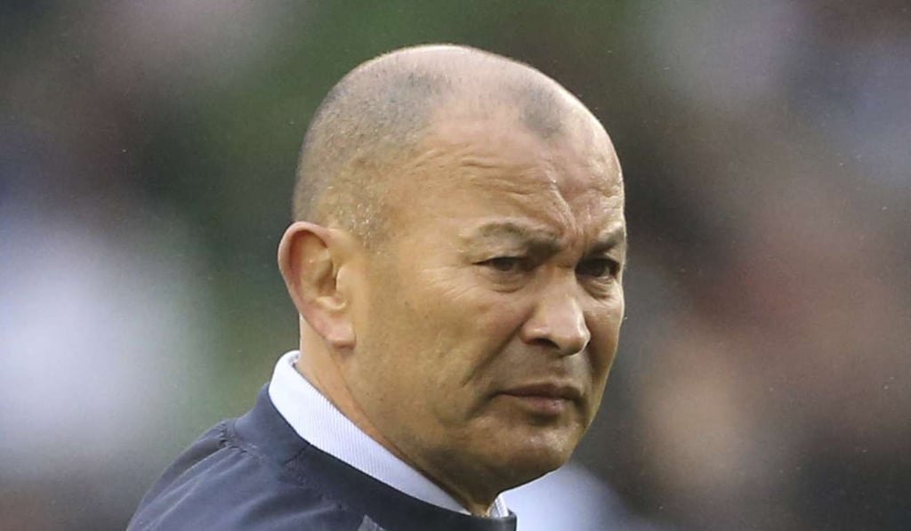 Eddie Jones refused to be bowed by the defeat. Photo: AP