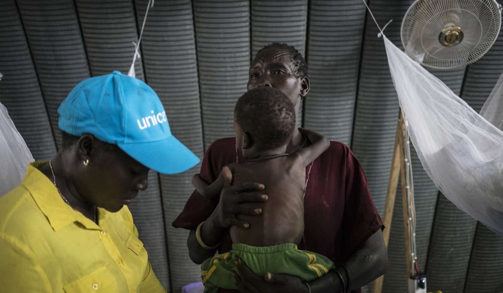 A mother holds her son who is suffering from severe malnutrition as a humanitarian worker weighs him, at a nutrition clinic in the United Nation's Protection of Civilians site in Juba, South Sudan. A total of 16 people were killed in ethnically-inspired attacks. Photo: UNICEF via AP)