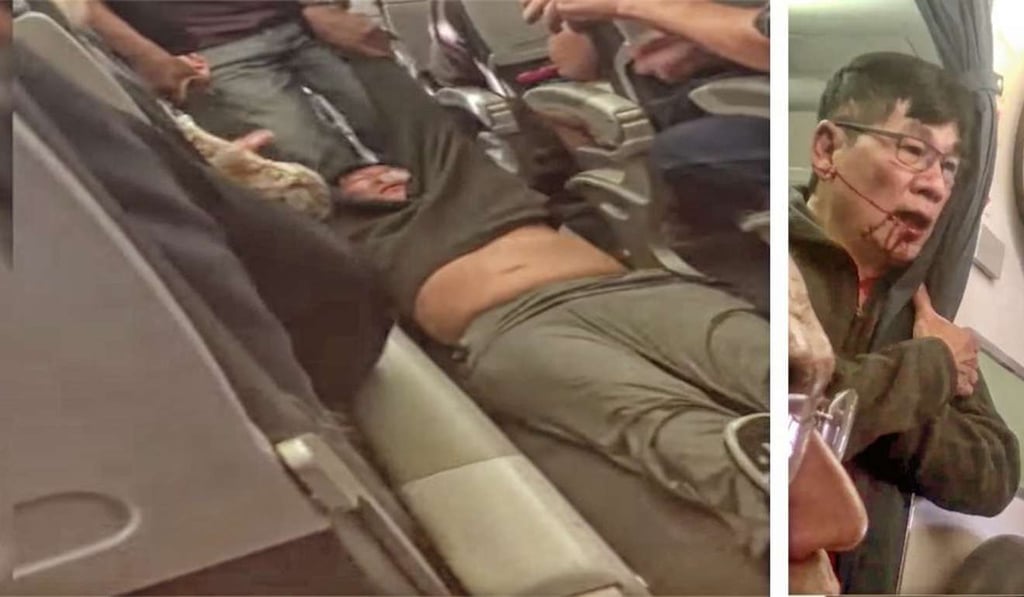 A bleeding passenger is dragged from a United Airlines flight in Chicago on Sunday. Photo: Twitter A bleeding passenger is dragged from a United Airlines flight in Chicago on Sunday. Photo: Twitter