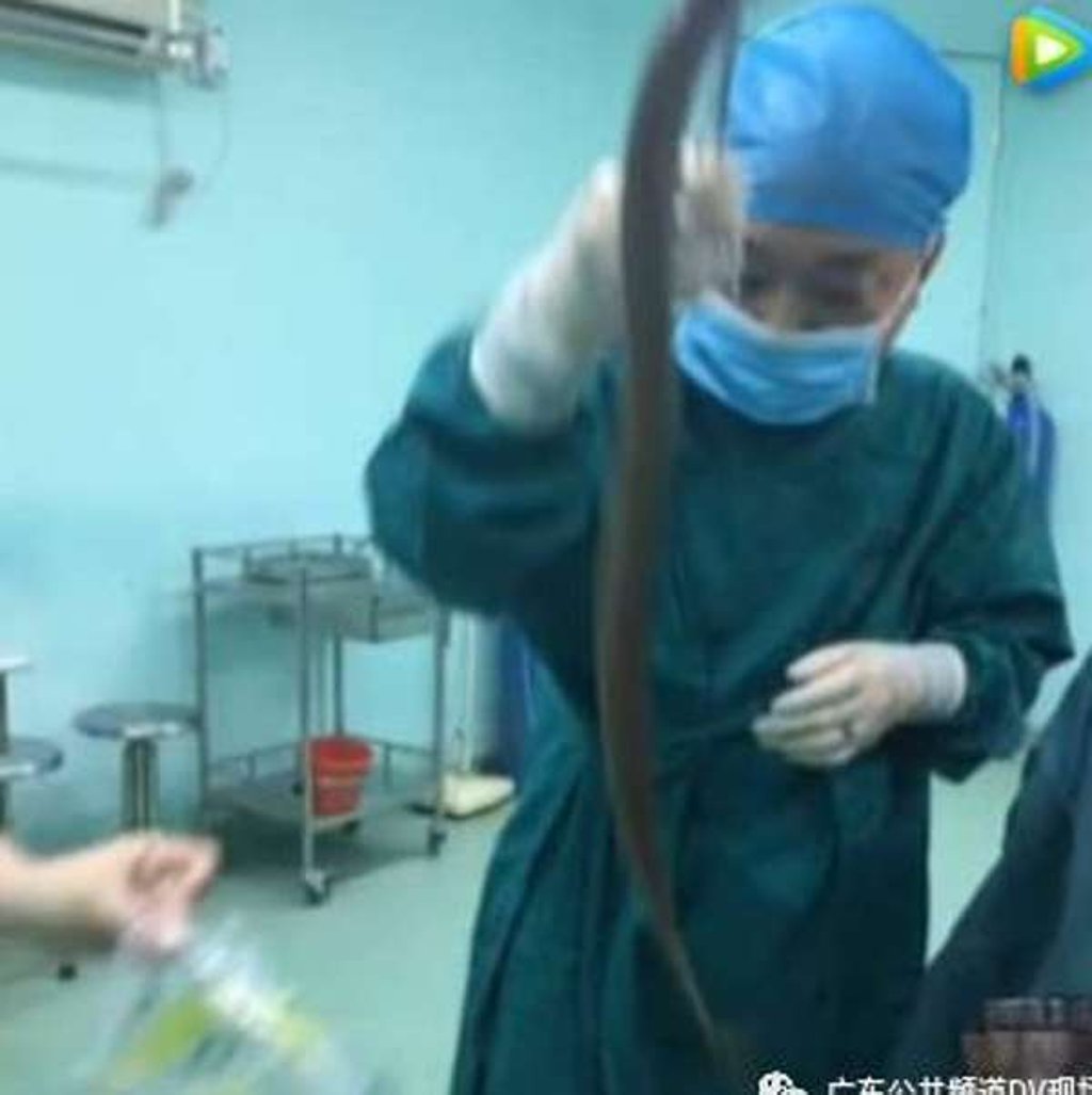 The man almost died after he inserted a live eel as a folk cure for constipation Photo: Handout The man almost died after he inserted a live eel as a folk cure for constipation Photo: Handout