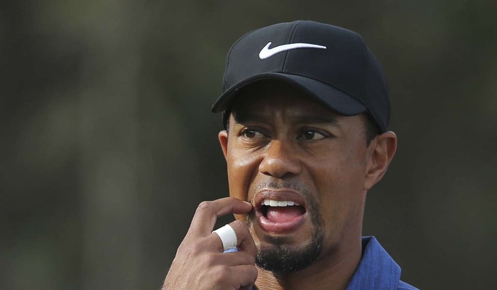 In this le photo, Tiger Woods reacts on the 11th hole during the first round of the Dubai Desert Classic golf tournament in Dubai, United Arab Emirates. Woods announced he has had a fourth back surgery. Photo: AP