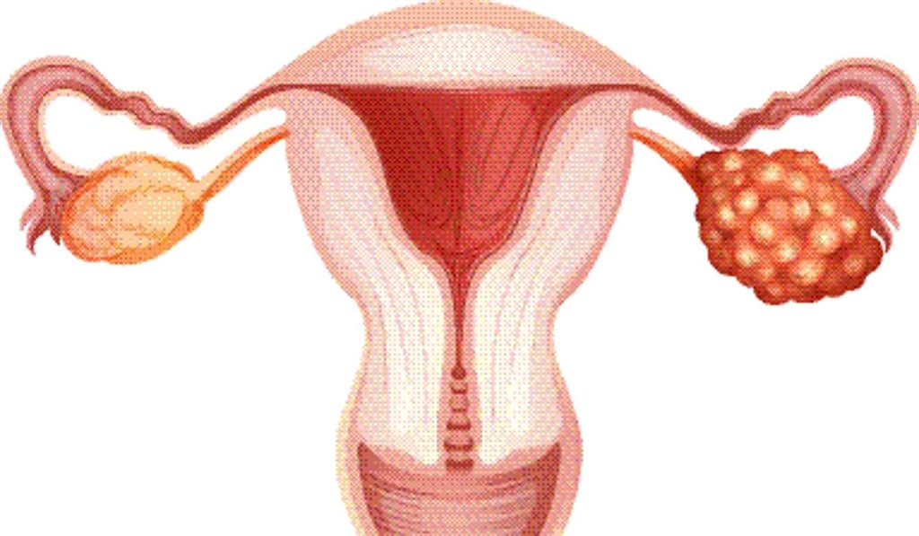 Ovarian cancer killed 208 women in Hong Kong in 2015. Photo: Shutterstock