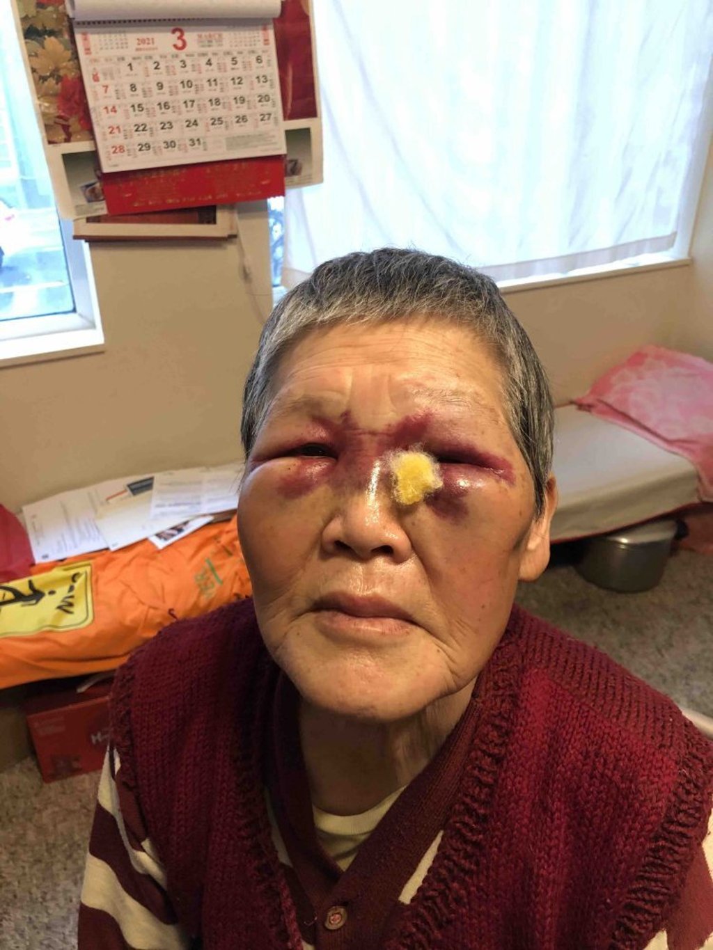 Xie’s family said she was emotional and cried often after the incident, but is slowly recovering from her injuries. Photo: GoFundMe Xie’s family said she was emotional and cried often after the incident, but is slowly recovering from her injuries. Photo: GoFundMe