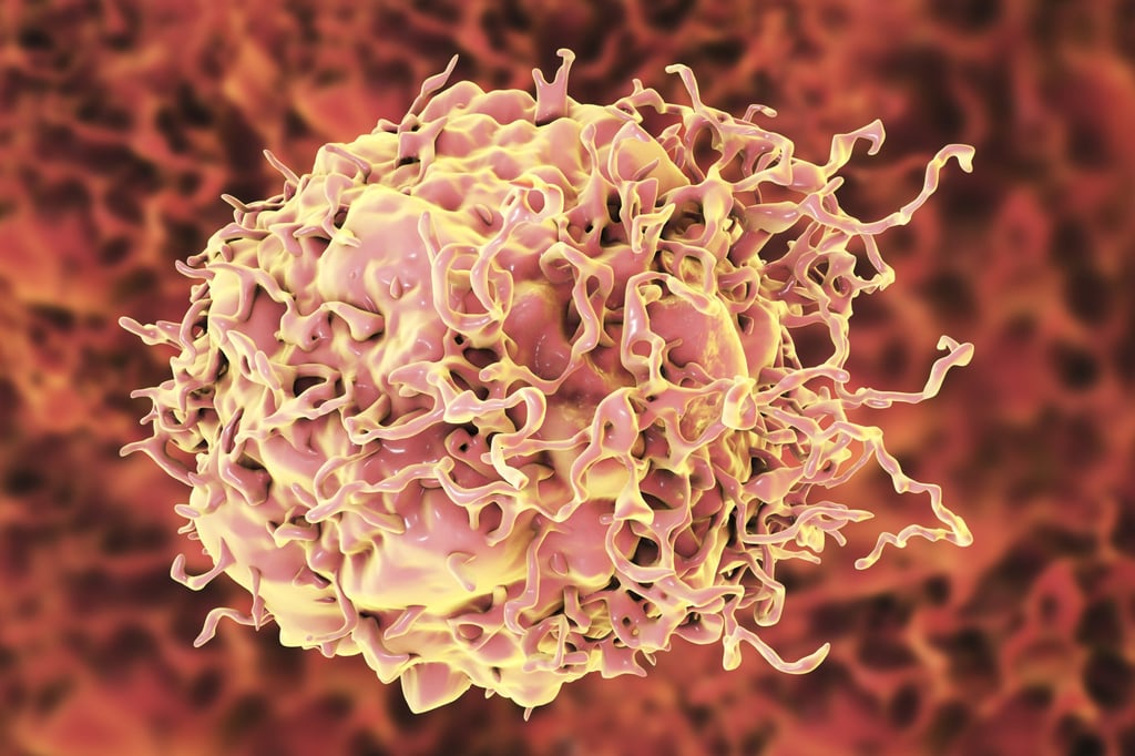 A computer illustration of a colon cancer cell. Photo: Getty Images/Science Photo Libra