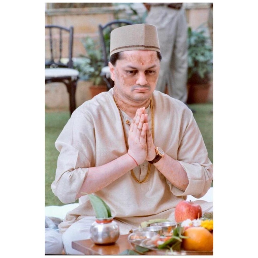 Gautam Singhania’s vitiligo results in pale patches on his skin. Photo: @gautamsinghania99/Instagram Gautam Singhania’s vitiligo results in pale patches on his skin. Photo: @gautamsinghania99/Instagram