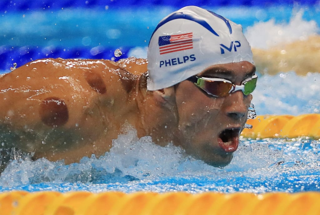 Michael Phelps of the US is seen with red cupping marks on his shoulder as he competes in the 2016 Rio Olympics. Photo: Reuters