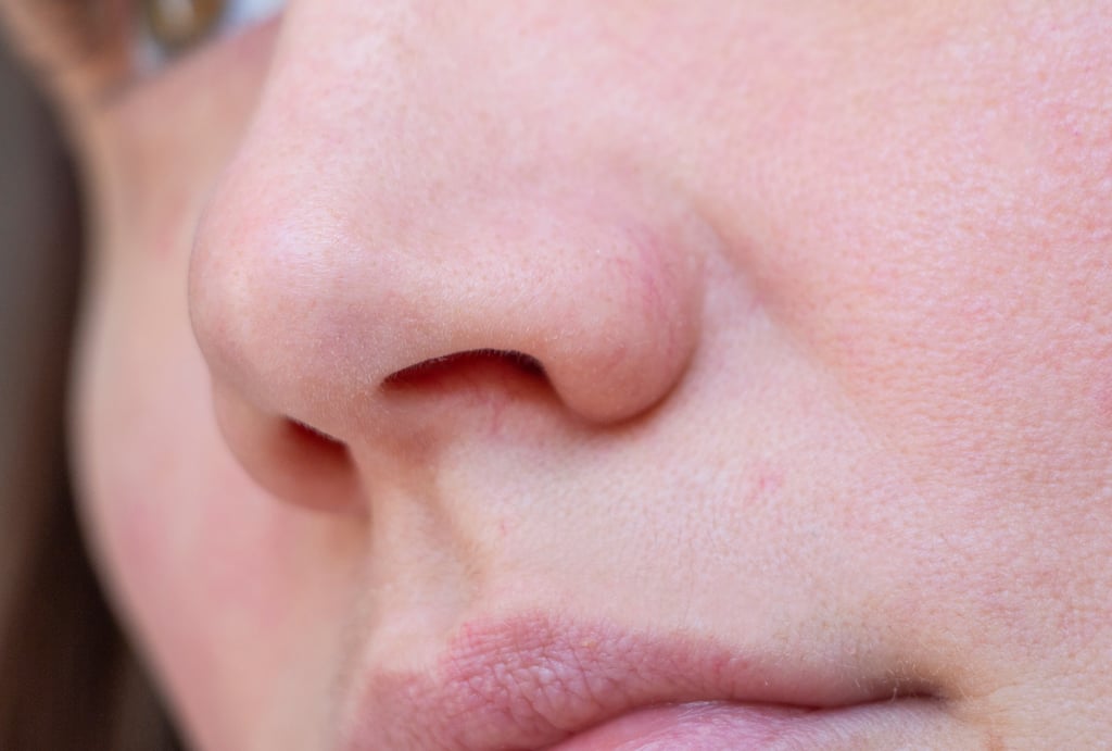 Those with dry skin usually struggle with it all over their bodies, but especially on the face, scalp, hands, legs and elbows. Photo: Shutterstock Those with dry skin usually struggle with it all over their bodies, but especially on the face, scalp, hands, legs and elbows. Photo: Shutterstock
