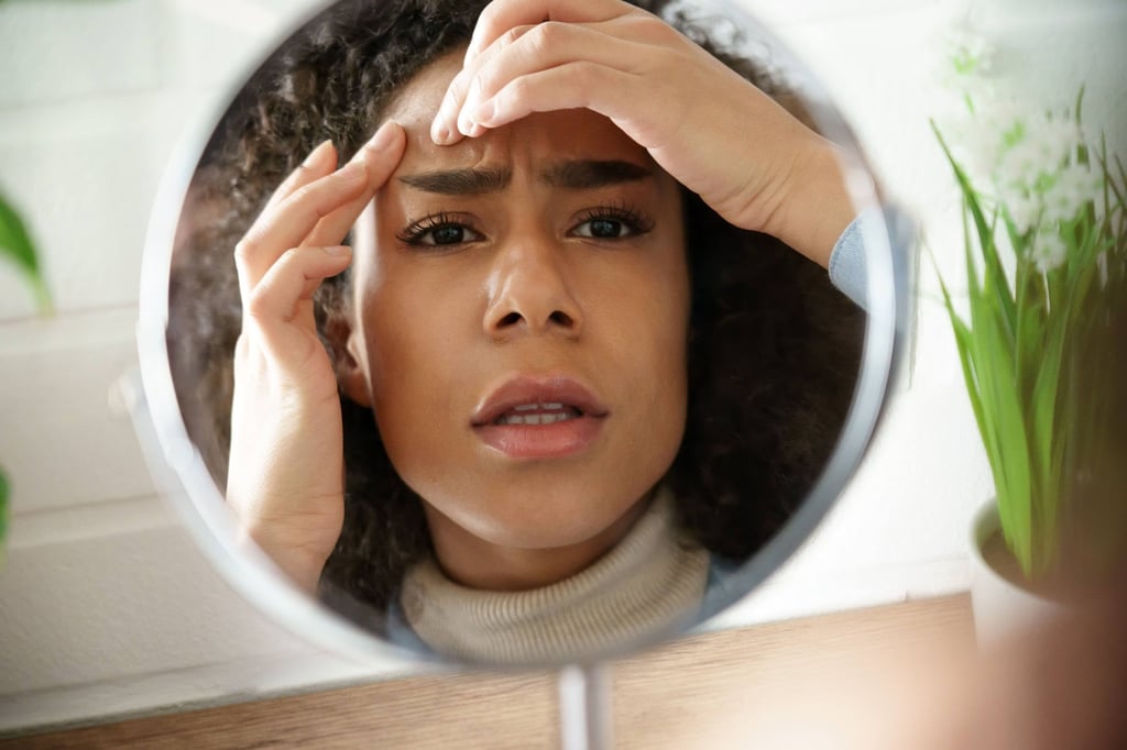 Blackheads (also known as comedones) are a type of acne. Photo: Shutterstock Blackheads (also known as comedones) are a type of acne. Photo: Shutterstock