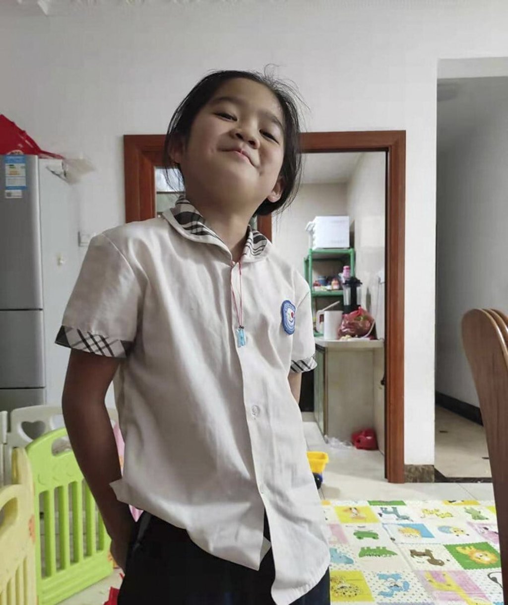 Tongtong was knocked down by a classmate when the students were running “excitedly” out of the classroom. Tongtong was knocked down by a classmate when the students were running “excitedly” out of the classroom.