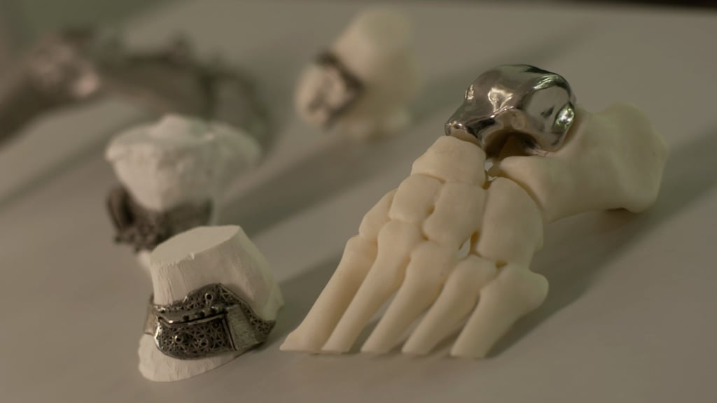 Koln 3D is known for its pioneering work creating metal 3D-printed, patient-specific bone implants for ankle and shoulder surgeries.