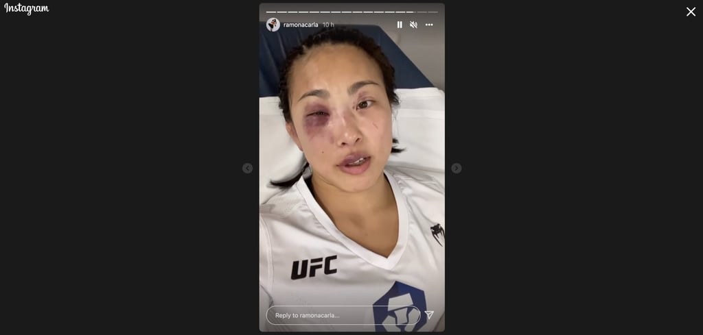 Ramona Pascual provides an update from hospital after her loss to Josiane Nunes at UFC Vegas 49. Ramona Pascual provides an update from hospital after her loss to Josiane Nunes at UFC Vegas 49.