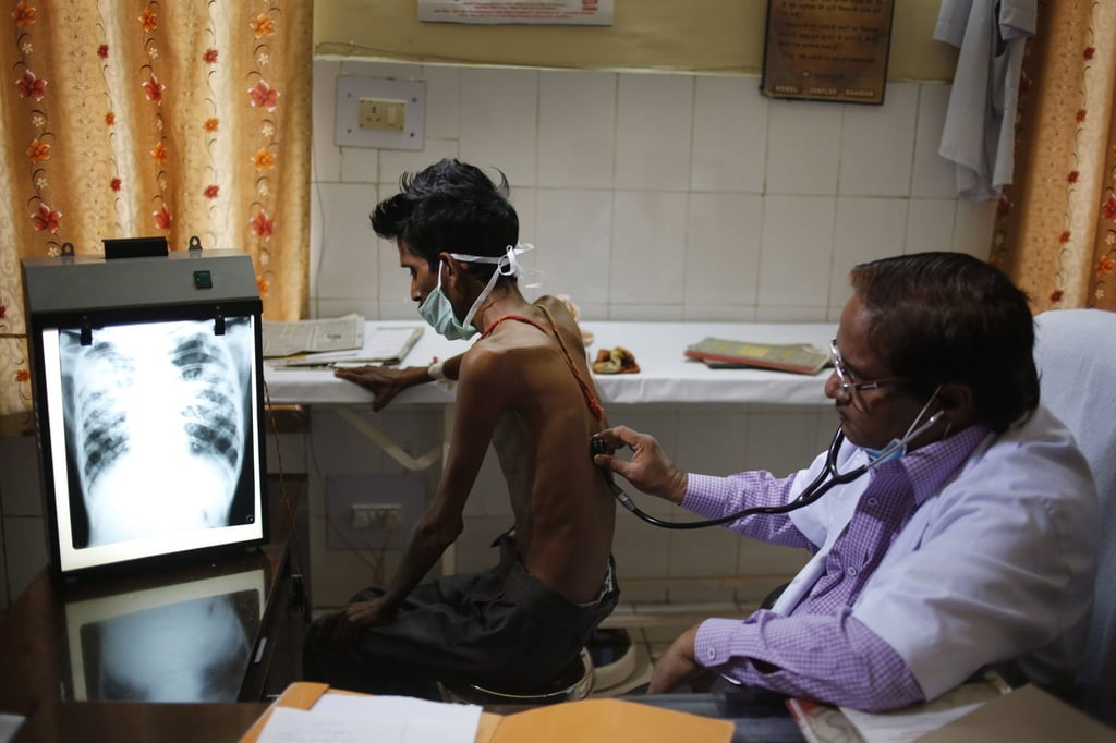 A doctor examines a tuberculosis patient in a government TB hospital in Allahabad, India. Photo: AP A doctor examines a tuberculosis patient in a government TB hospital in Allahabad, India. Photo: AP
