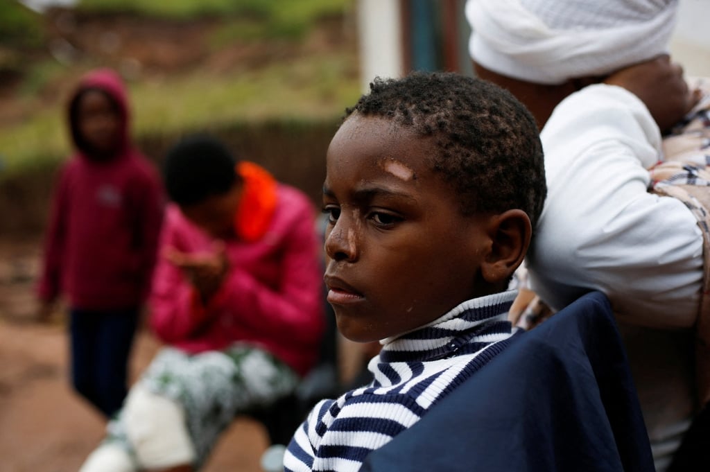 A child looks on as he recovers from injuries after the house he was sleeping in collapsed during flooding in Mzinyathi near Durban, South Africa on April 17. Photo: Reuters A child looks on as he recovers from injuries after the house he was sleeping in collapsed during flooding in Mzinyathi near Durban, South Africa on April 17. Photo: Reuters