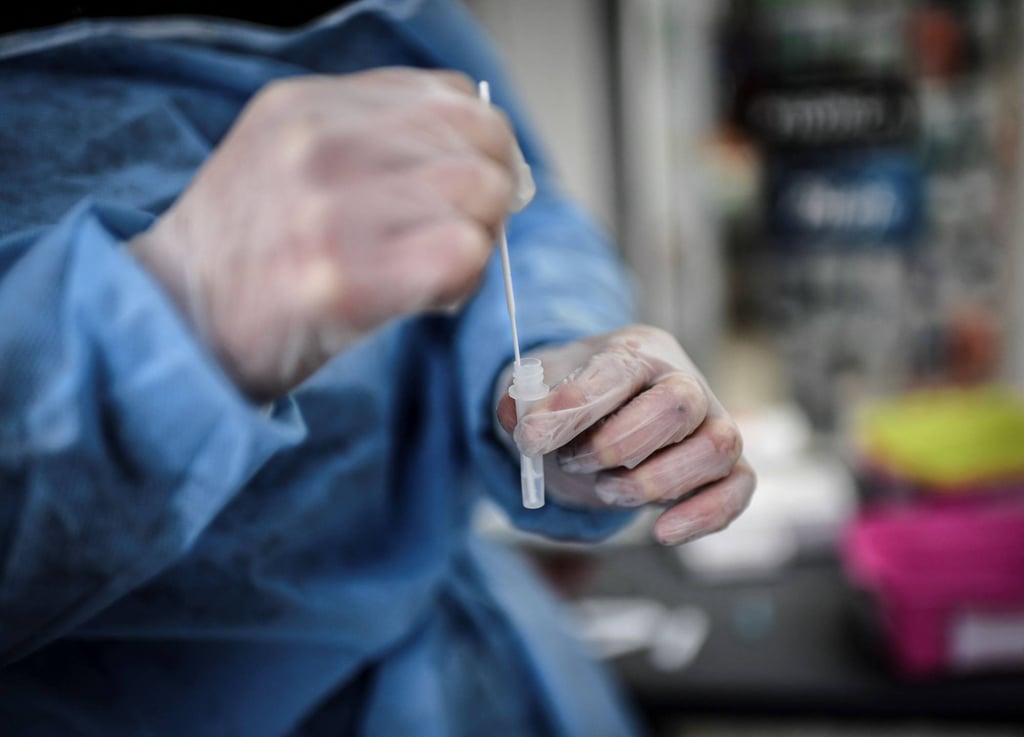 A medical staff holds up a sample collected from a patient tested for the novel coronavirus Covid-19 In December 2021. Photo: AFP