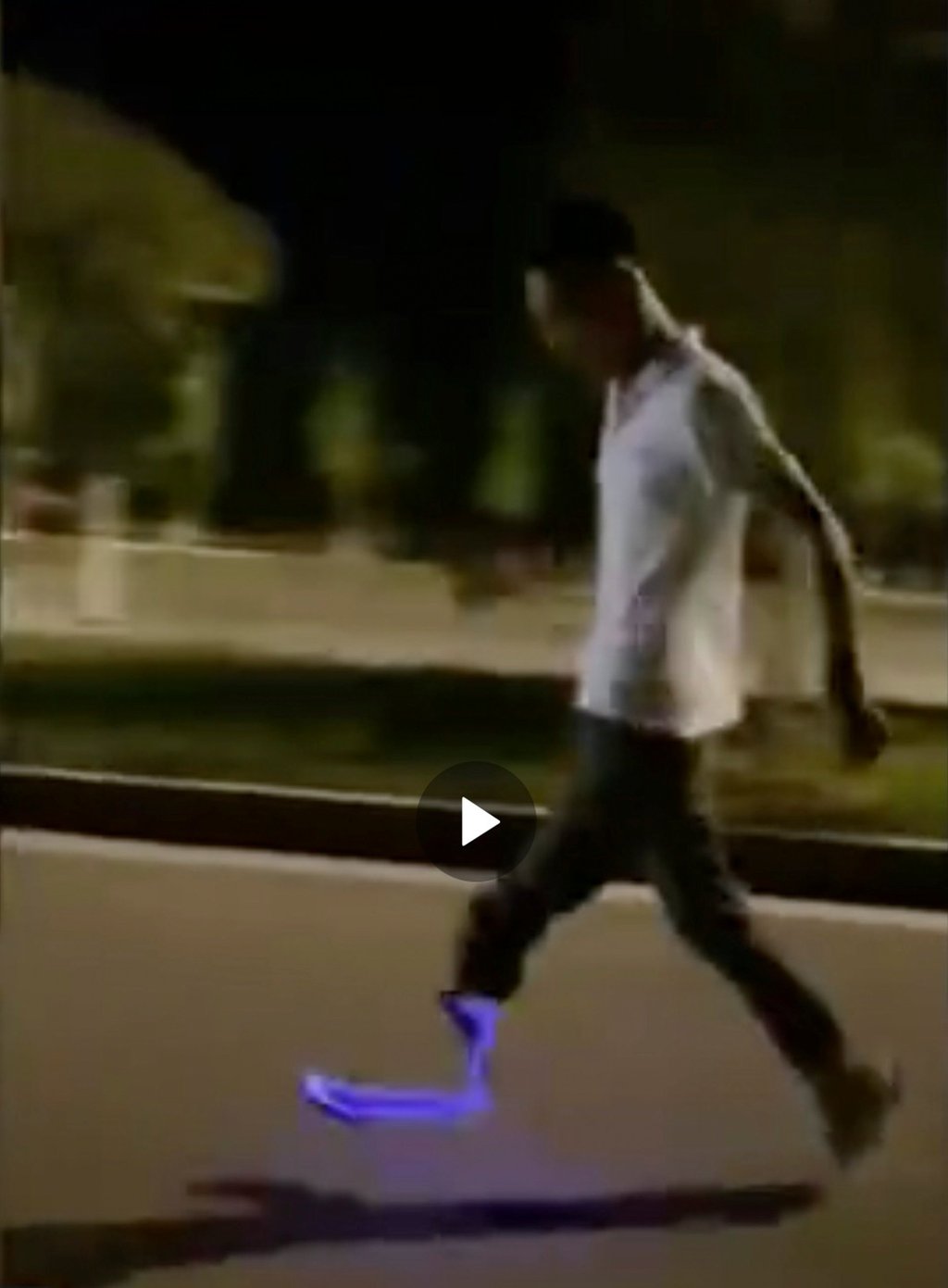 Liang designed his prosthetic leg to attract attention, rather than to trying to disguise it. Photo: Weibo Liang designed his prosthetic leg to attract attention, rather than to trying to disguise it. Photo: Weibo