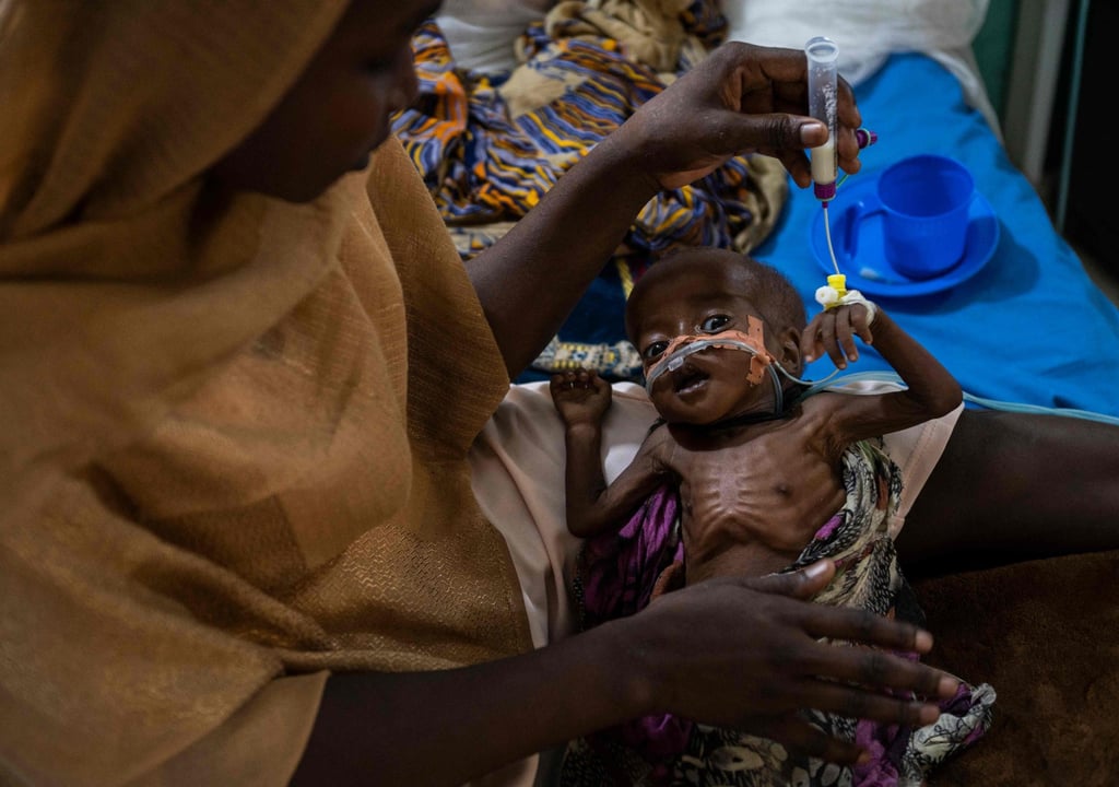 A malnourished child being fed by his mother in Chad; 263 million more people will crash into extreme poverty this year, says Oxfam. Photo: AFP A malnourished child being fed by his mother in Chad; 263 million more people will crash into extreme poverty this year, says Oxfam. Photo: AFP