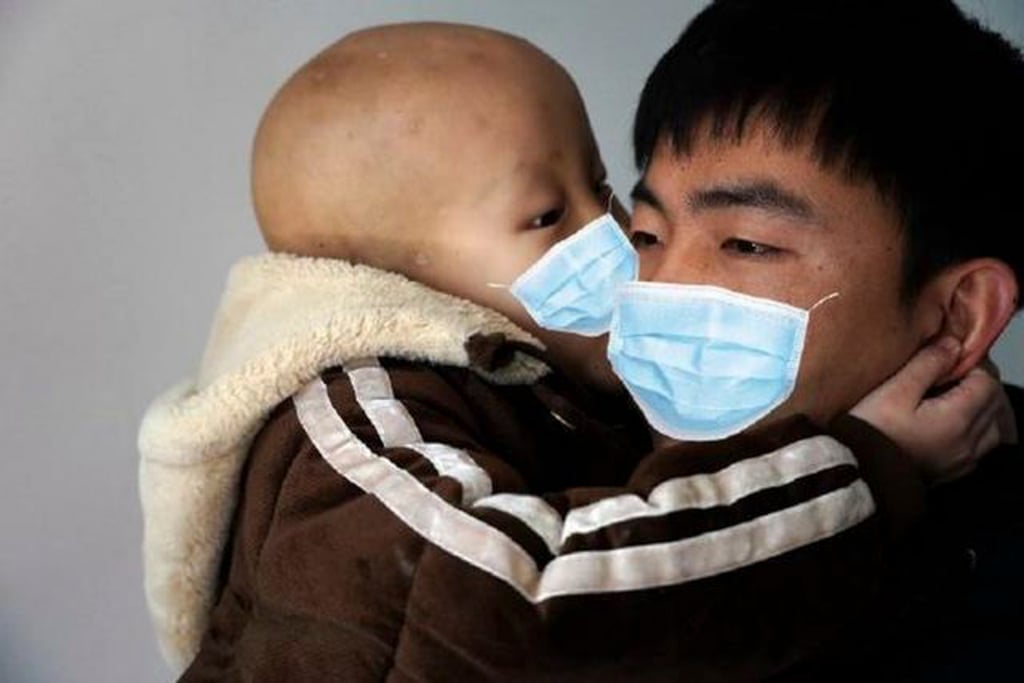 Xiaoxuan has been battling a cancer named rhabdomyoma for four years. Photo: Weibo Xiaoxuan has been battling a cancer named rhabdomyoma for four years. Photo: Weibo