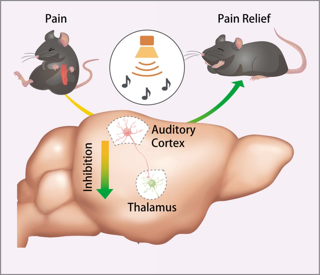 The scientists concluded that the parts of the nervous system that process pain and sound interact with each other. Photo: University of Science and Technology of China