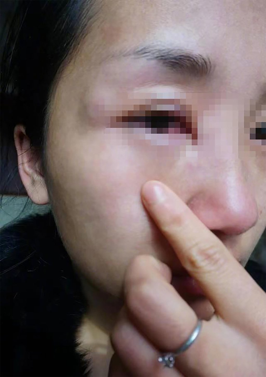 Tang Ping shows injury she says were caused by her husband. Photo: Weibo