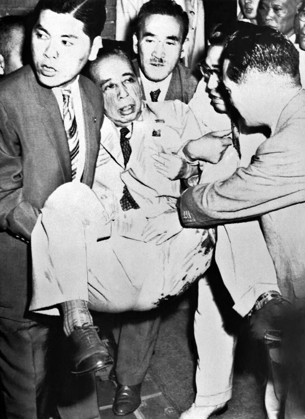 Japanese Prime Minister Nobusuke Kishi is evacuated after being stabbed six times in his left leg at his home by a fanatic in 1960. Photo: AFP Japanese Prime Minister Nobusuke Kishi is evacuated after being stabbed six times in his left leg at his home by a fanatic in 1960. Photo: AFP