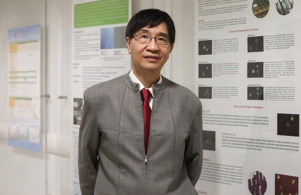 Yuen does not know how he caught the virus. Photo: Jonathan Wong Yuen does not know how he caught the virus. Photo: Jonathan Wong