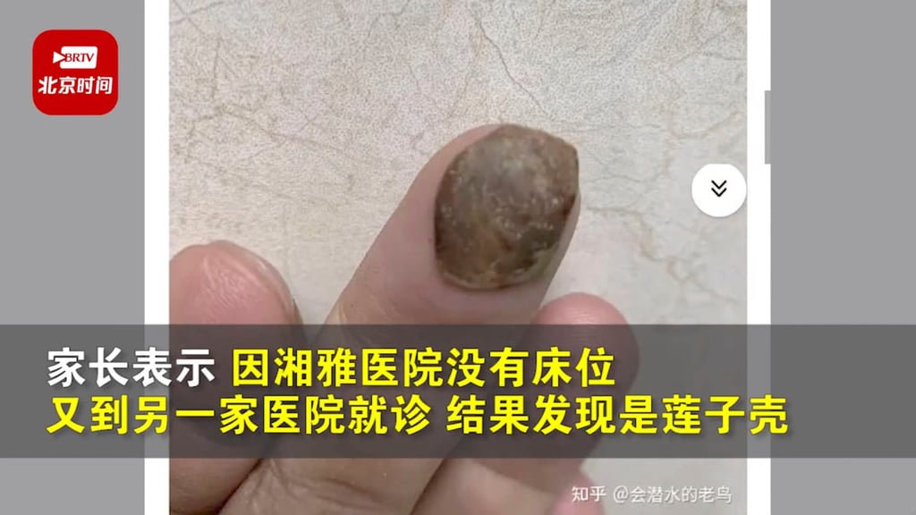 The family believe the shell got into the child’s mouth after they bought lotus seeds during a trip to the countryside. Photo: Toutiao