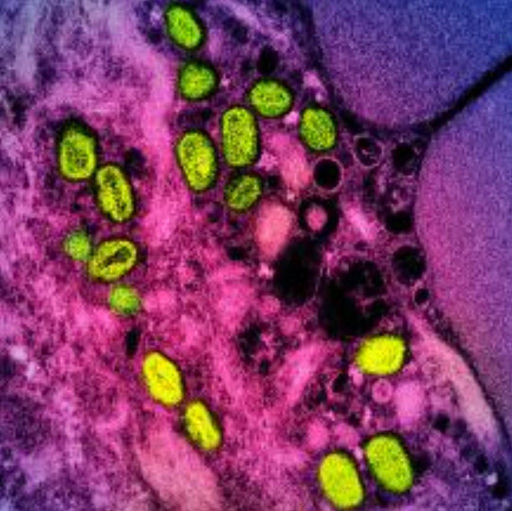 A colorized transmission electron micrograph of monkeypox particles (green) found within an infected cell (pink and purple), cultured in the laboratory. Photo: National Institute of Allergy and Infectious Diseases/Handout/ AFP A colorized transmission electron micrograph of monkeypox particles (green) found within an infected cell (pink and purple), cultured in the laboratory. Photo: National Institute of Allergy and Infectious Diseases/Handout/ AFP