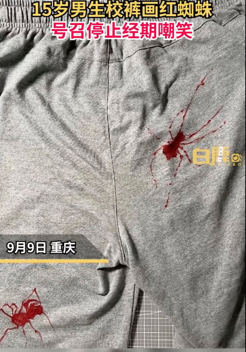 A boy drew spiders on his trousers as a way to stand up for a girl who was mocked. Photo: Weibo A boy drew spiders on his trousers as a way to stand up for a girl who was mocked. Photo: Weibo
