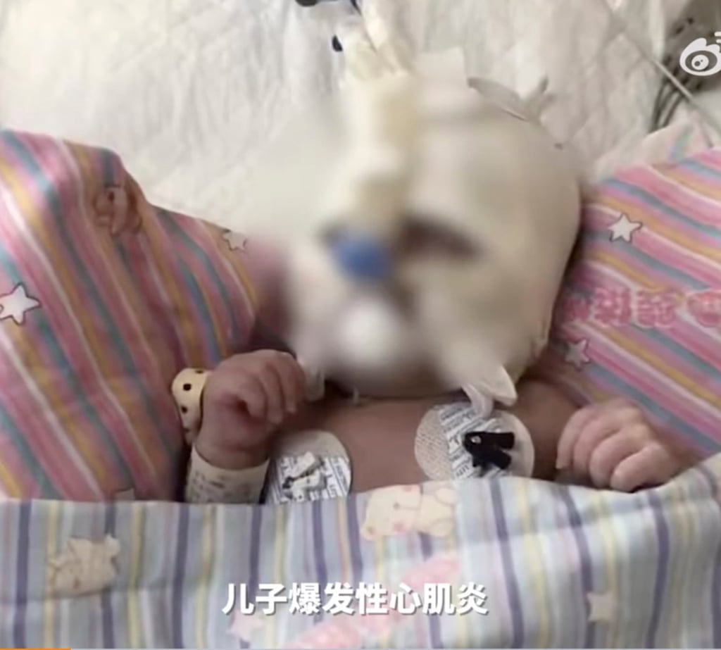 A photo of Meng’s baby when he was in the hospital. Photo: Weibo