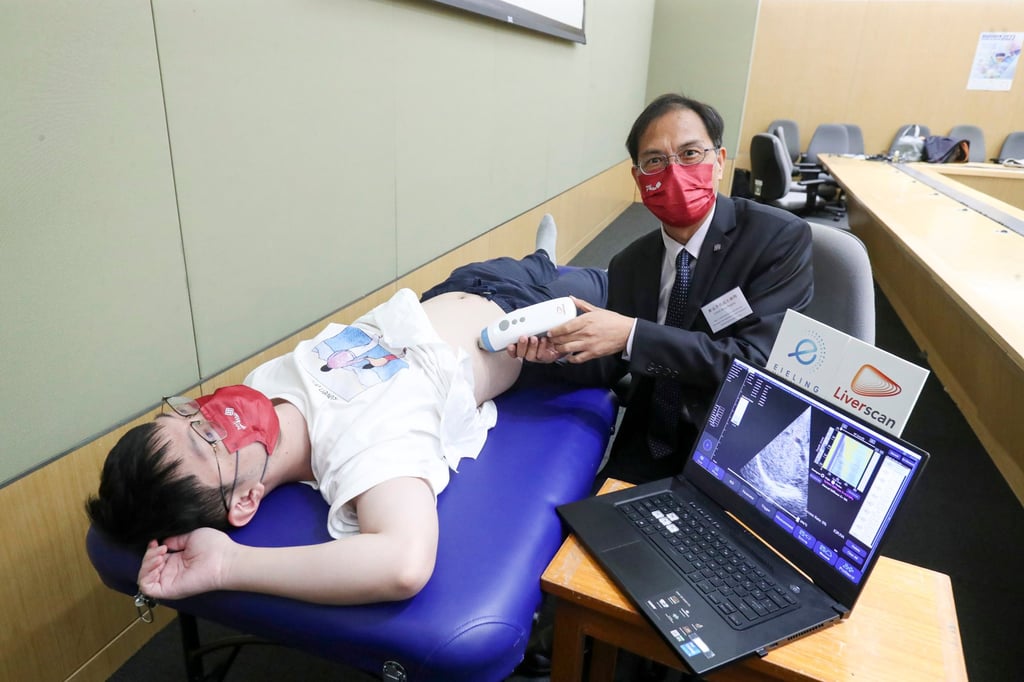 A palm-sized device called Liverscan invented by Professor Zheng Yongping and his team will also be displayed at the event. Photo: Handout