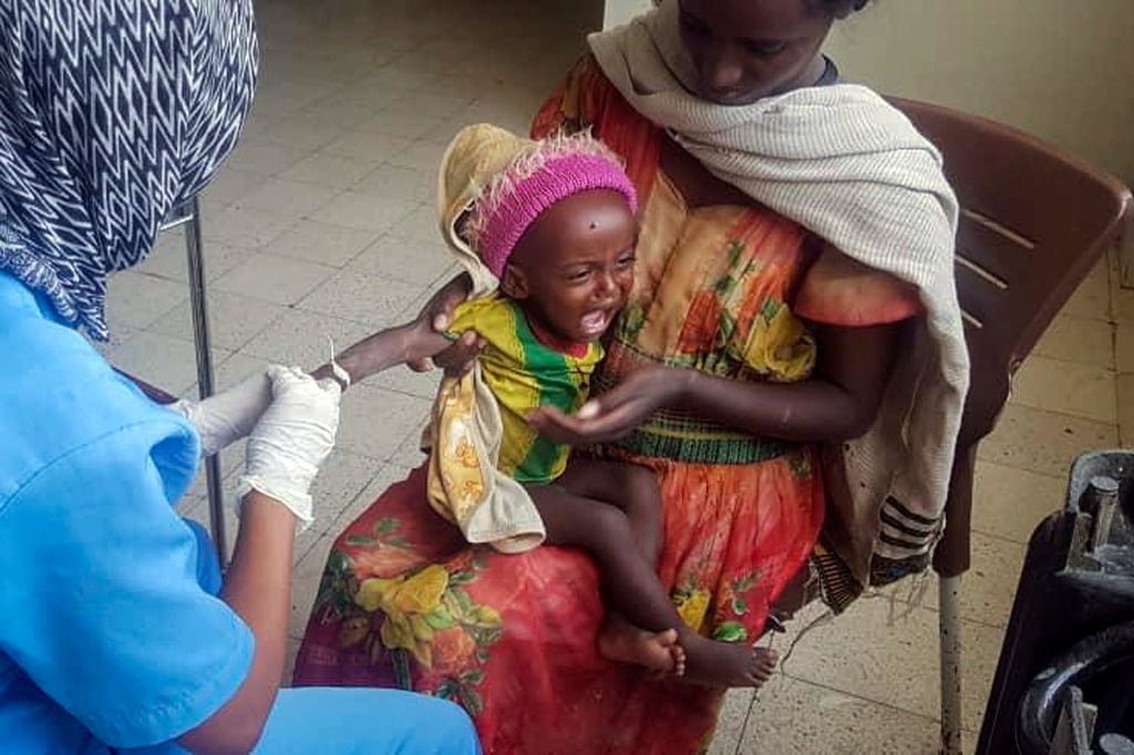 One-year-old Medhin Gereziher is treated for malnutrition at the Ayder Referral Hospital in Mekele, in the Tigray region of northern Ethiopia, on October 4. Photo: AP One-year-old Medhin Gereziher is treated for malnutrition at the Ayder Referral Hospital in Mekele, in the Tigray region of northern Ethiopia, on October 4. Photo: AP