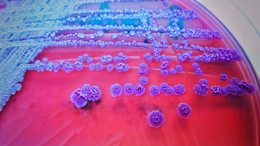 Burkholderia pseudomallei causes melioidosis and can be found in soil and water. Photo: Shutterstock Images Burkholderia pseudomallei causes melioidosis and can be found in soil and water. Photo: Shutterstock Images