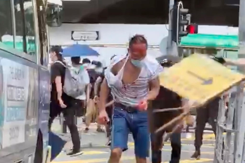 A 41-year-old lawyer after he was assaulted by a move when he confronted them over vandalism during a 2020 protest against the proposed national security law. Photo: Handout