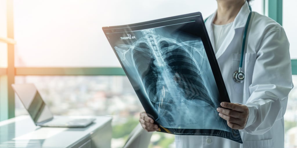 A doctor examines a chest X-ray of a patient with emphysema. Photo: Shutterstock A doctor examines a chest X-ray of a patient with emphysema. Photo: Shutterstock