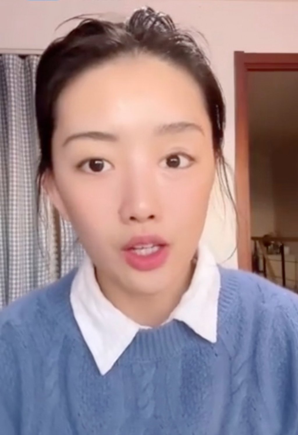 Xintong had to overcome years of self-doubt and negative comments from others following the loss of her right eye. Photo: Baidu.