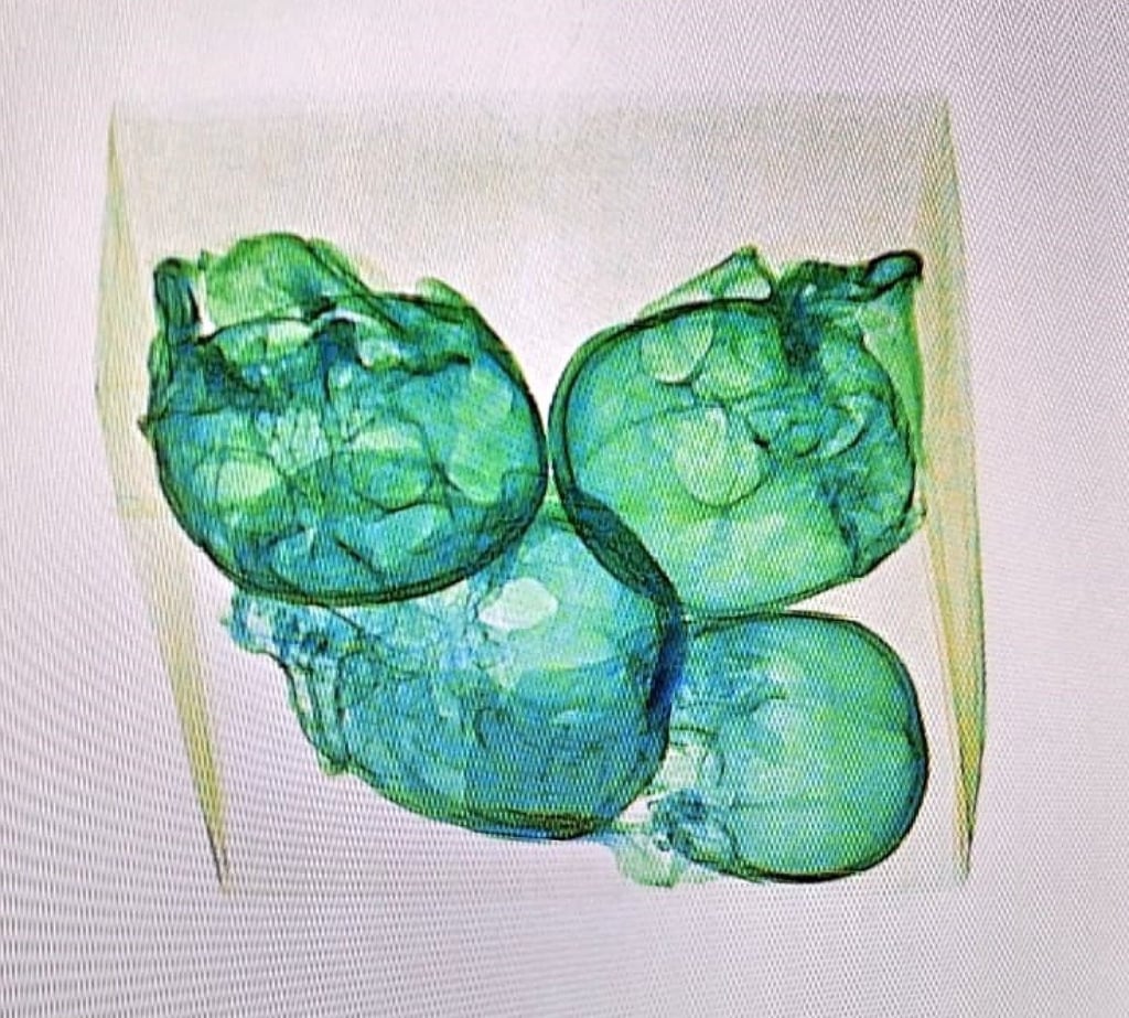 Four human skulls wrapped in plastic and aluminium foil were detected by X-ray equipment at the Queretaro Intercontinental airport in Mexico. Photo: Mexico’s National Guard via Reuters