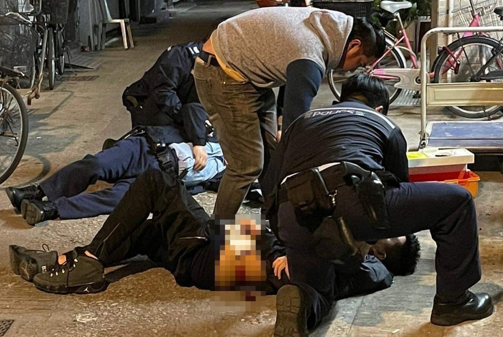 Police attend to a 43-year-old Filipino man who was hit by three shots in thewaist and arm. Photo: Handout