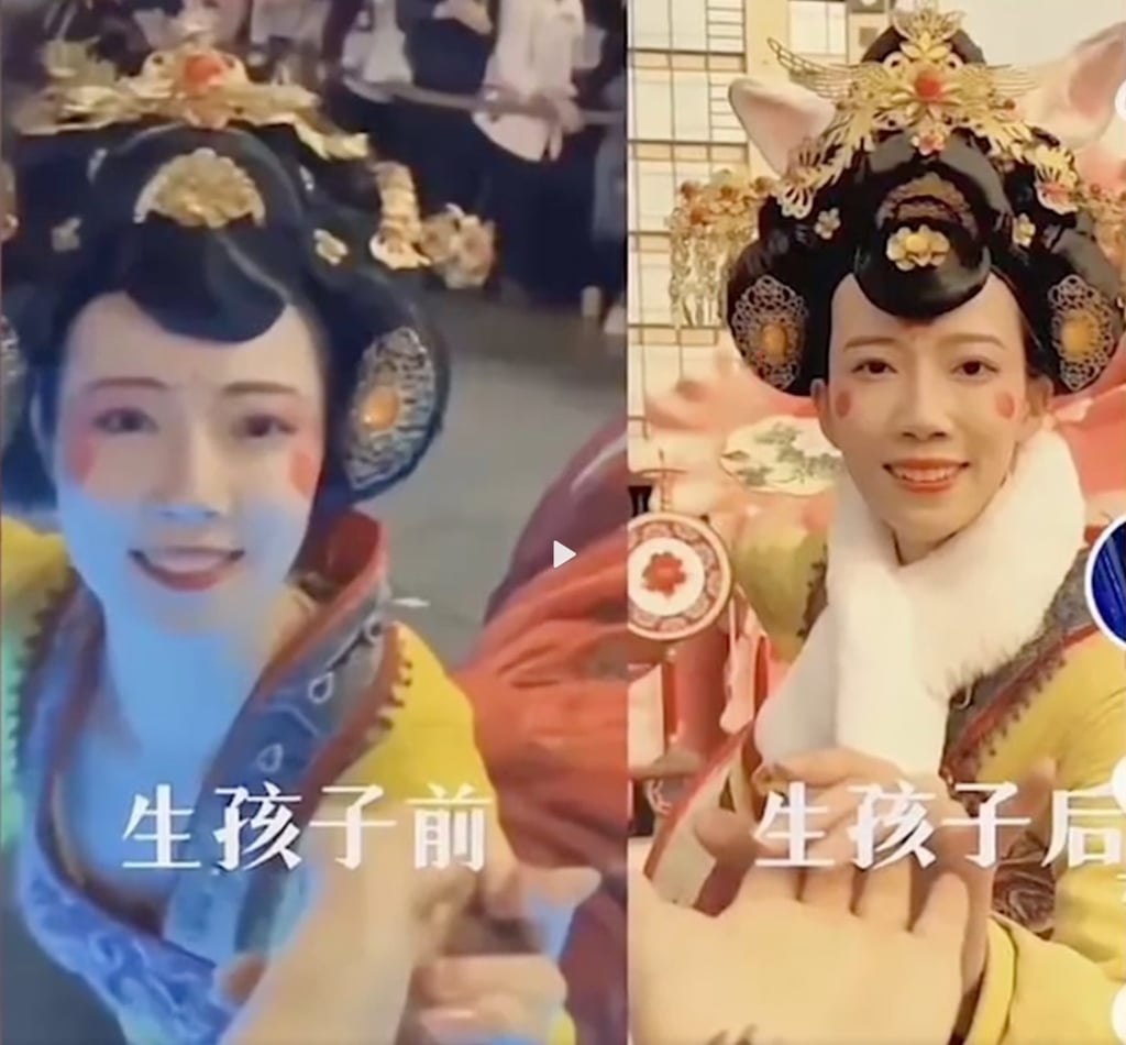 The online critic’s before (left photo) and after childbirth comparison of the dancer caused a storm of angry responses from other social media users. Photo: Weibo