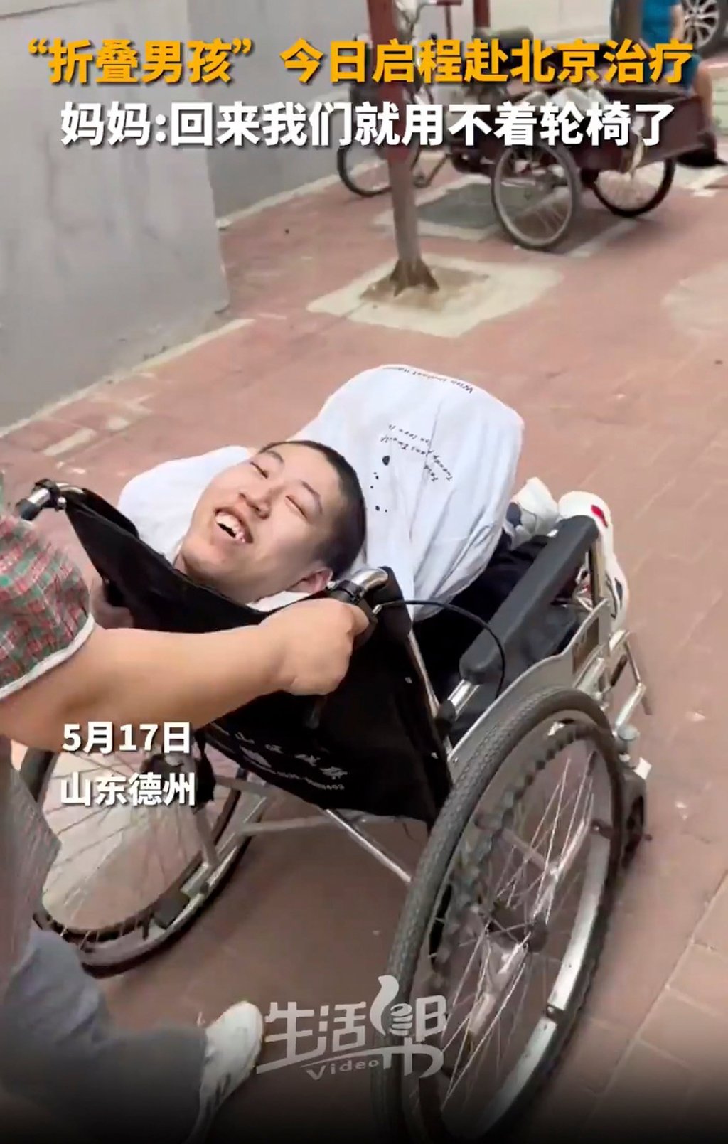 Jiang Yanchen has shown remarkable resilience throughout years of pain and discomfort. Photo: xhby.net