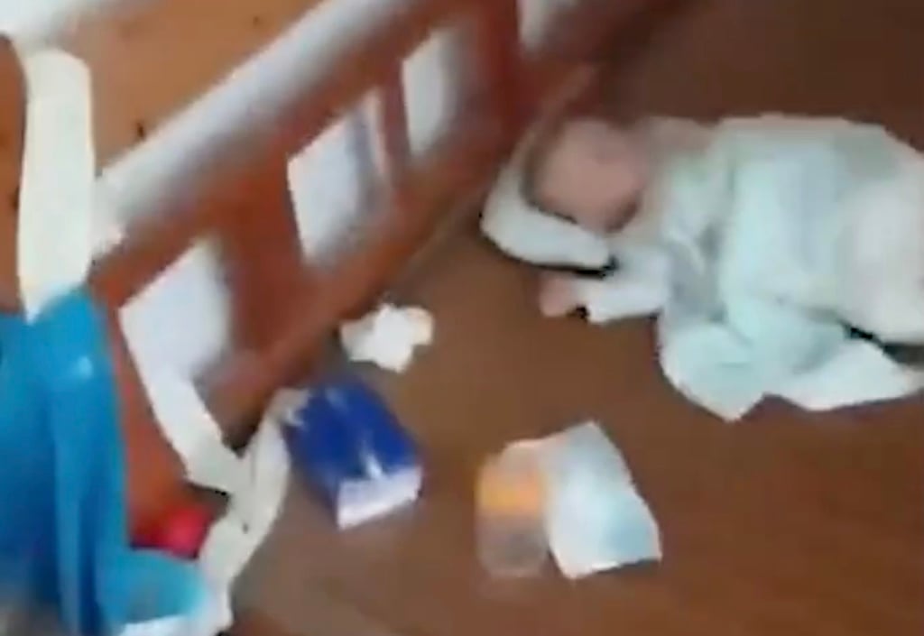 The infant boy was slapped in the face so many times by his father that it became red and swollen. Photo: The Paper The infant boy was slapped in the face so many times by his father that it became red and swollen. Photo: The Paper