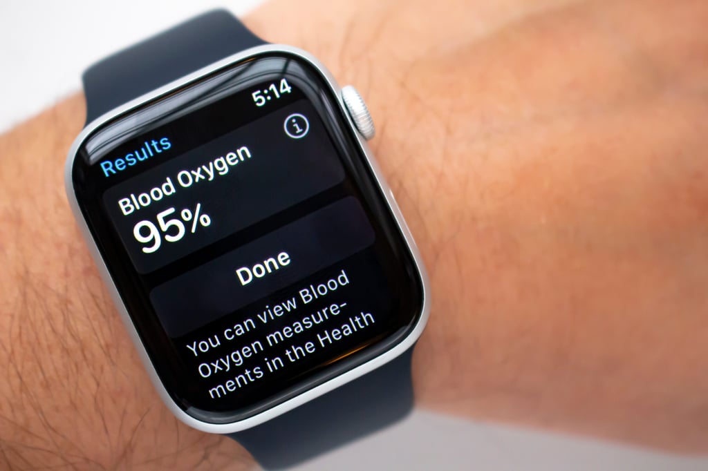 An Apple Watch goes beyond just telling time. Photo: Shutterstock