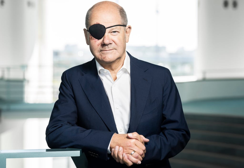 German Chancellor Olaf Scholz has tweeted a pirate-style picture of himself with a black eye patch and dark-red bruises. Photo: Handout via AP German Chancellor Olaf Scholz has tweeted a pirate-style picture of himself with a black eye patch and dark-red bruises. Photo: Handout via AP