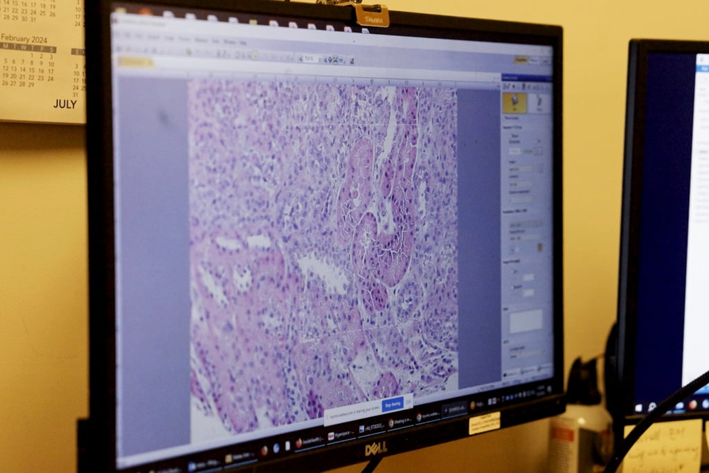 Researchers are racing to learn how to use animal organs to save human lives. Photo: AP