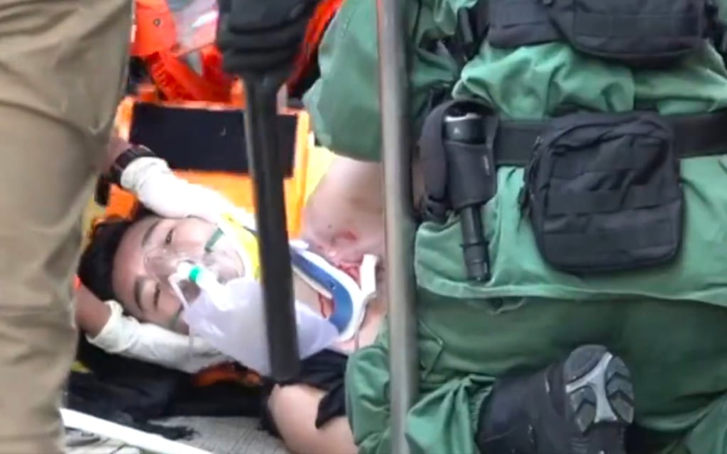 Student Tsang Chi-kin was shot by police during the 2019 anti-government protests. Photo: Handout Student Tsang Chi-kin was shot by police during the 2019 anti-government protests. Photo: Handout