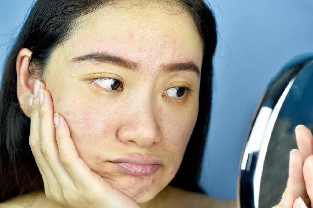 Nutrient deficiencies can result in visible skin problems
